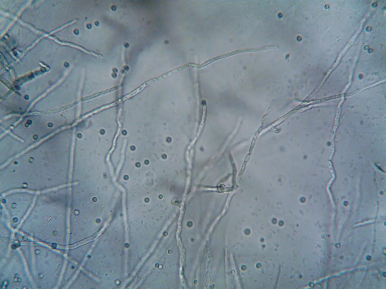 Black spots appear around a cold, damp air vent